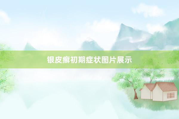银皮癣初期症状图片展示